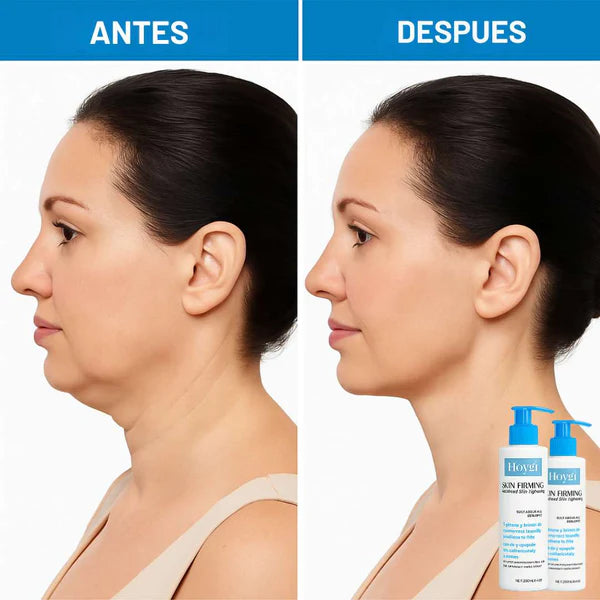 Compra 1, Llévate 2 HOYGI + 2 Crema Aclarante de REGALO 50% ACC